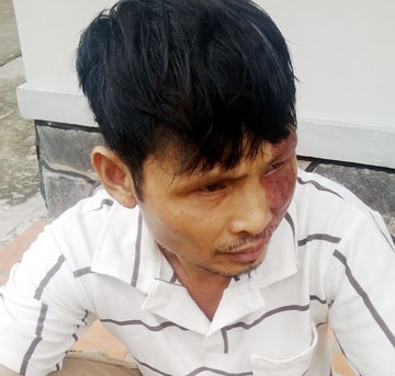 Ông Sơn mắt đỏ ngầu vì thương con. Ảnh: TK 