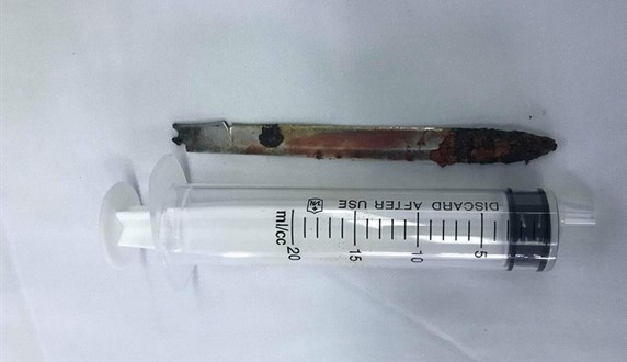 Lưỡi dao dài 13 cm nằm ở lưng của bệnh nhân Nam. Ảnh: Hoàng Yến.