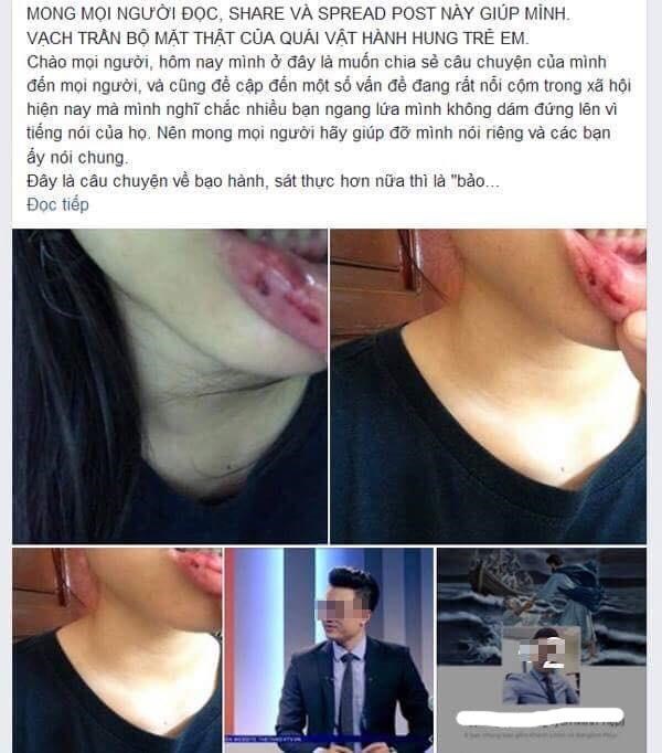 T.D tố cáo anh rể bạo hành trên Facebook. (Ảnh chụp màn hình Facebook)