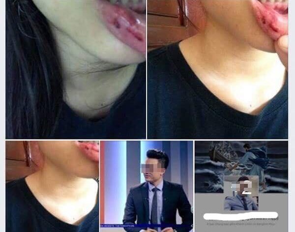 T.D tố cáo anh rể bạo hành trên Facebook. (Ảnh chụp màn hình Facebook)