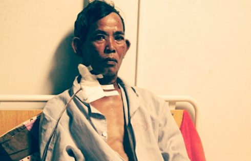 Ông Nguyễn Tường bị đâm 4 nhát và đang nằm viện điều trị.