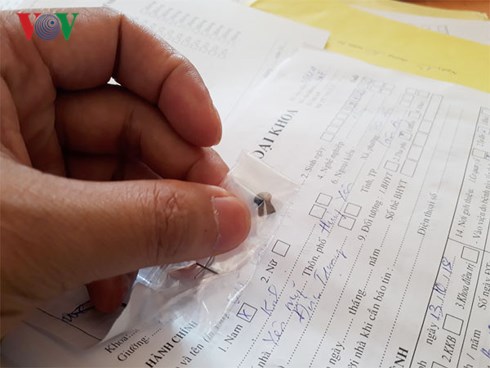 Viên đạn chì được lấy ra từ bụng của nạn nhân