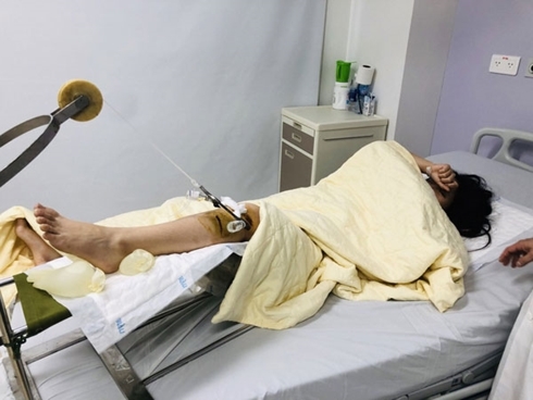 Nạn nhân đang điều trị tại bệnh viện. (Ảnh: Vũ Văn Tiến)
