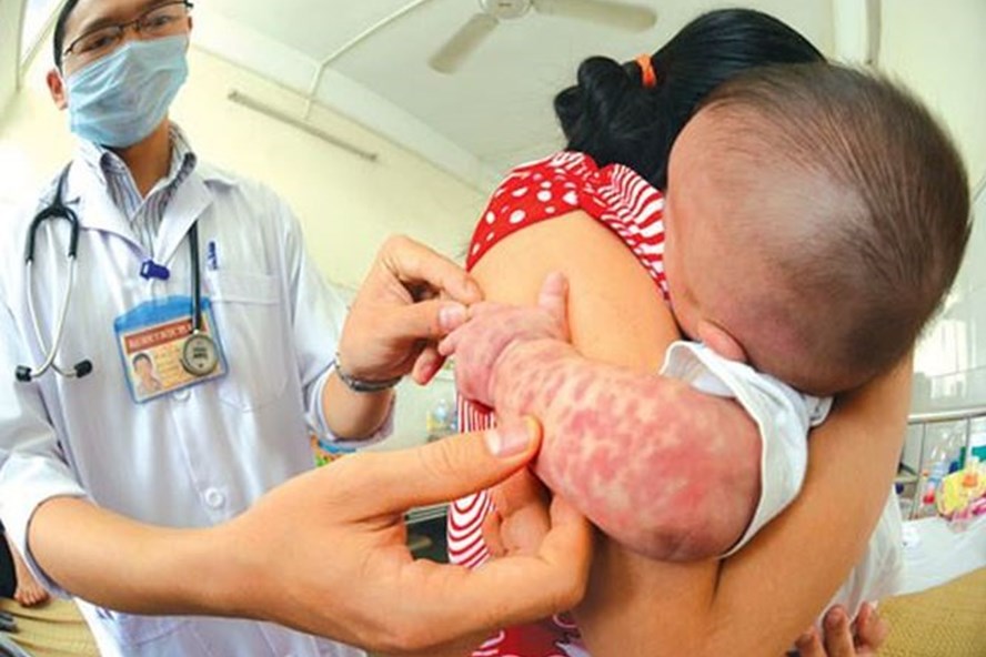 Mặc dù bệnh sởi là bệnh phòng được bởi vắc - xin nhưng những năm gần đây số ca mắc sởi đã tăng lên 30%, việc từ chối tiêm đã khiến căn bệnh này trỗi dậy và đe doạ sức khoẻ con người