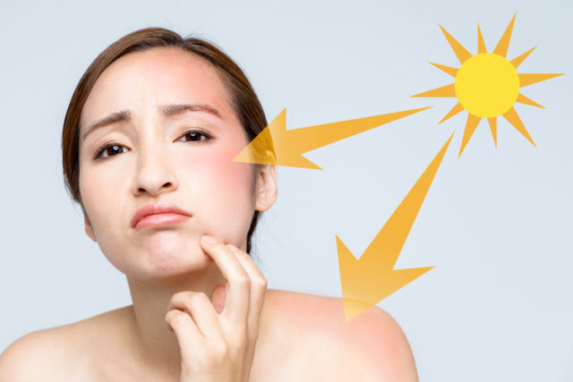 Ngứa khi ánh nắng mặt trời chiếu vào.